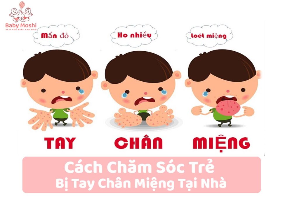 cach-cham-soc-be-bi-tay-chan-mieng-tai-nha