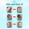 Gối lõm cho bé chất liệu cao su non chống bẹp đầu 7 goi-lom-cao-su-non-chong-bep-dau-3
