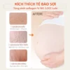 Kem Chống Rạn Mamashuo - Làm mờ rạn trắng, đỏ hiệu quả 11 kem-chong-ran-da-Mamashuo-50g-1