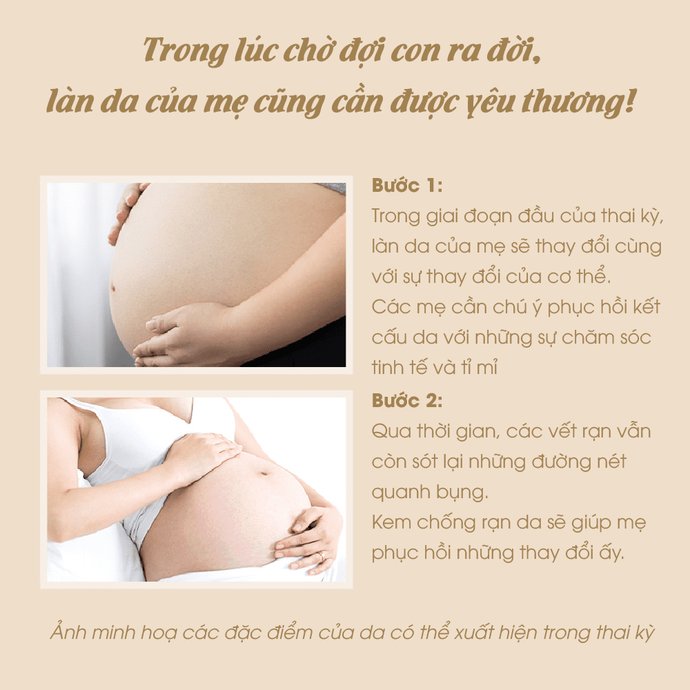 kem-ran-da-cho-ba-bau-atono2-200ml-han-quoc-9220-1